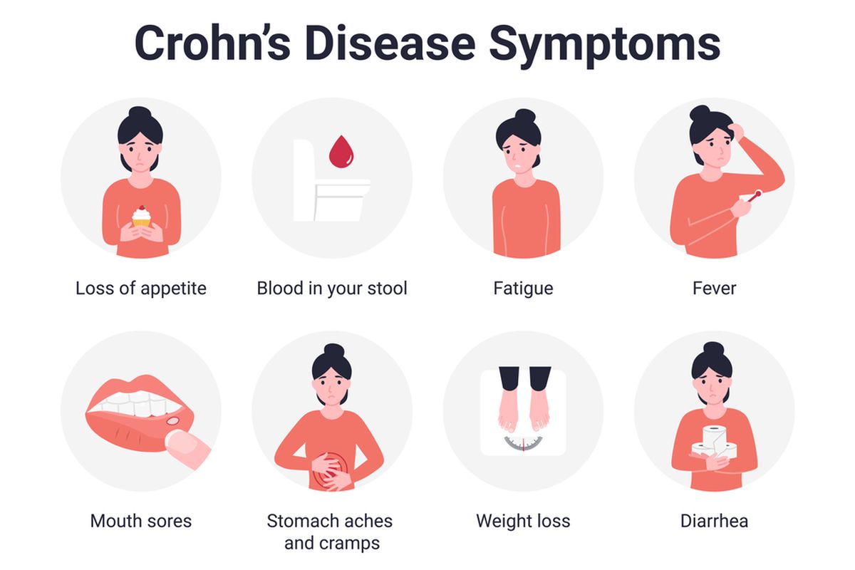 Ilustrasi Crohn's Disease