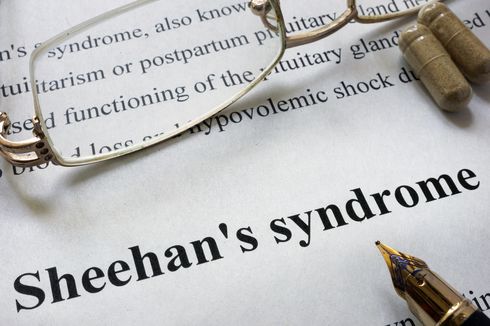 Sindrom Sheehan