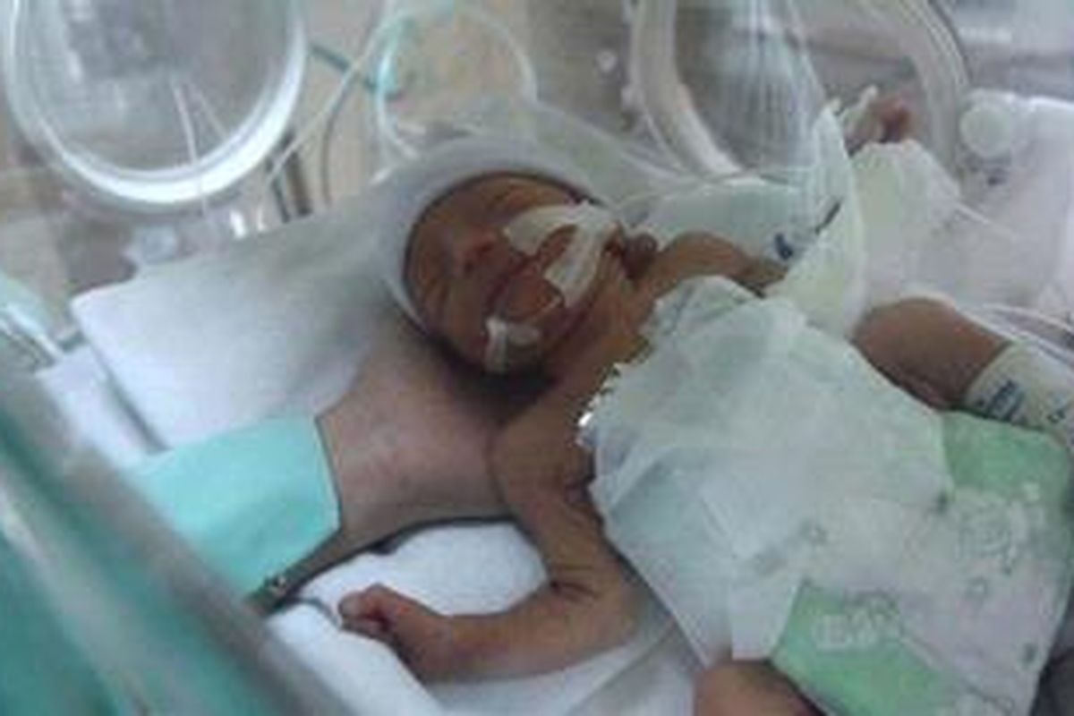 Dara Nur Anggraini dirawat didalam inkubator di ruang Neonatus Intensive Care Unit (NICU) RSUD Tarakan, Jakarta Pusat, Senin (18/2/2013). Bayi  lahir prematur dengan berat hanya 1,6 kilogram itu kondisi membaik namun masih di bawah pengawasan yang ketat. Sebelumnya saudara kembarnya meninggal dunia karena kesulitan mendapat ruang perawatan NICU di sejumlah rumah sakit di Jakarta.