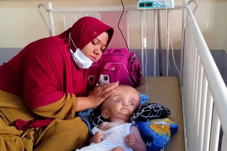 Teuku Achmad Rayan (1,9) bulan terbaring lemah di Rumah Sakit Umum Zainal Abidin (RSUZA) Banda Aceh, Provinsi Aceh, Kamis (16/2/2023).