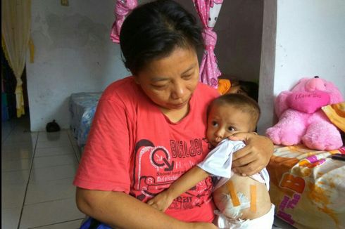 Kisah Iqbal, Bayi yang Terlahir Tanpa Lubang Anus dan Kaki Kiri