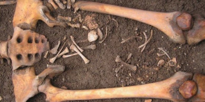 Kelahiran coffin, melahirkan setelah kematian. Arkeolog menemukan kerangka kepala dan badan janin ditemukan di antara tulang paha sementara tulang kaki masih ada di dalam lubang pelvis.