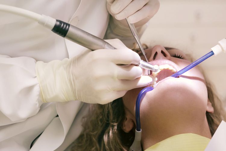 Perawatan gigi yang ditanggung BPJS Kesehatan.