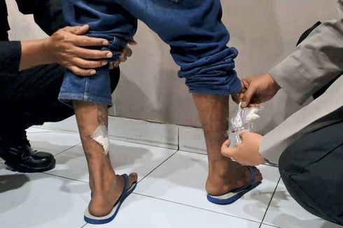 Penyelundupan Pil Koplo di Lapas Yogyakarta Digagalkan, Obat Ditempel di Betis