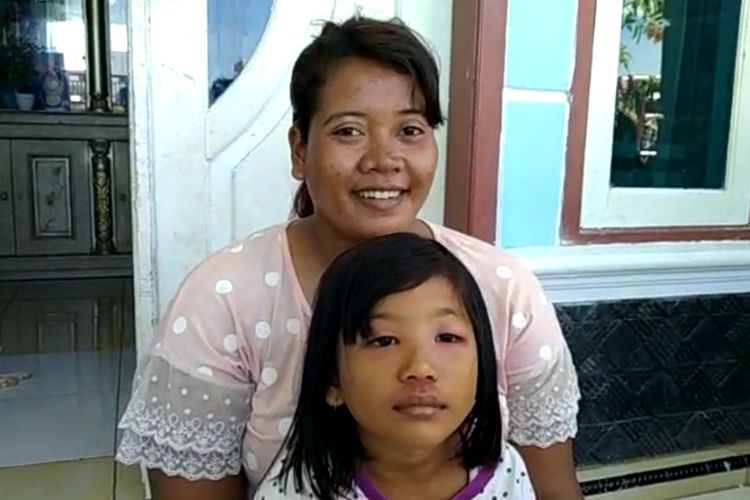 Rantinih (20), warga Pabean Udik, Indramayu, Jawa Barat, saat menunjukan anaknya terserang Tomcat, Selasa (1/9/2020)