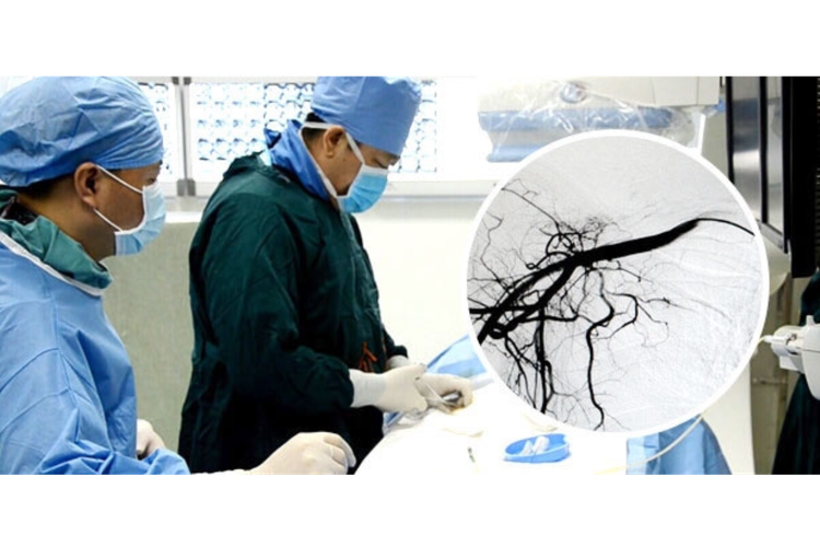Metode intervensi, salah satu pengobatan minimal invasif yang dimiliki St. Stamford Modern Cancer Hospital Guangzhou.