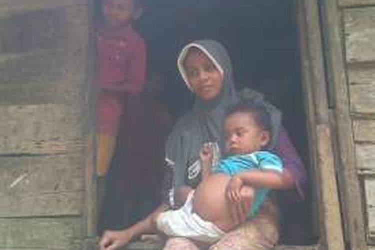 Fakhrul Ula, penderita gizi buruk asal digendong ibunya di rumah mereka Desa Seumirah, Kecamatan Nisam Antara, Aceh Utara, 