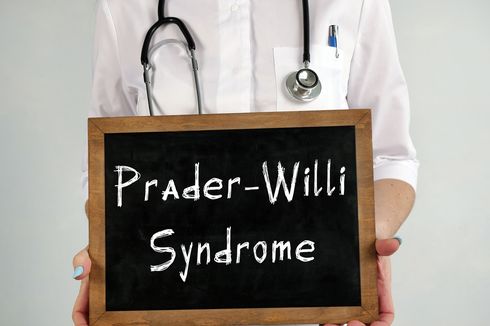 Sindrom Prader-Willi