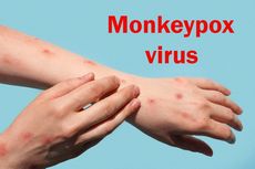 CEK FAKTA: Benarkah Vaksin AstraZeneca Sebabkan Cacar Monyet?