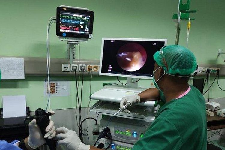 Tim Intervensi Pulmonologi dan kedokteran Respirasi didampingi oleh dokter anestesi  Rumah Sakit Umum Daerah dr Zainoel Abidin (RSUDZA) Banda Aceh, Senin (12/6/2023) berhasil mengeluarkan gigi palsu yang tertelan sejak 15 tahun yang lalu. 