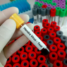 Epidemiolog Unair: Virus Hendra Lebih Mematikan daripada Covid-19