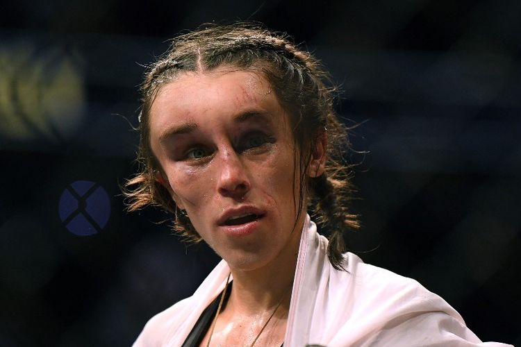 Petarung UFC, Joanna Jedrzejczyk, seusai pertarungan melawan Zhang Weili pada UFC 248, Minggu (8/3/2020) pagi WIB.