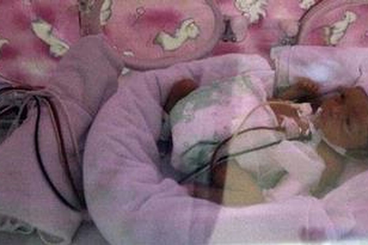 Dara Nur Anggraini, bayi kembar tujuh bulan yang kini dirawat di RSUD Tarakan, Jakarta Pusat, Selasa (19/1/2013). Saudari kembarnya Dera Nur Anggraini yang didiagnosis mengalami gangguan pencernaan dan tenggorokan sudah meninggal dunia, Sabtu (16/2/2013) karena tidak mendapatkan perawatan dengan pearalatan yang memadai.