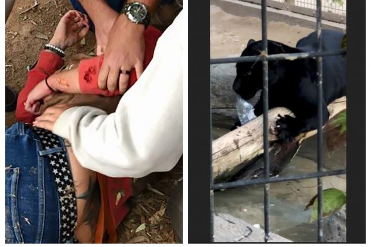 Ilustrasi wanita terluka akibat cakaran jaguar