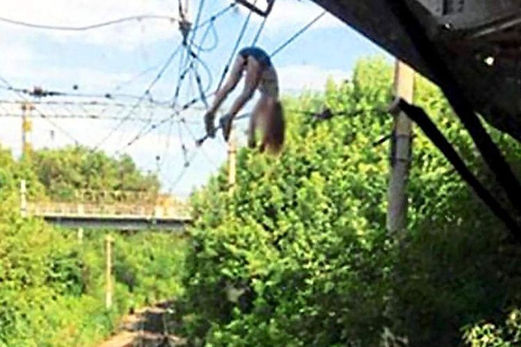 Foto gadis 13 tahun di Rusia yang tersangkut di kabel listrik 3.000 Volt setelah terjatuh karena selfie di jembatan rel kereta.