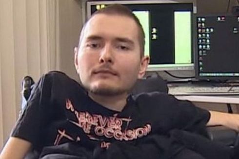 Pria Rusia Siap Jadi Subyek Pertama Transplantasi Kepala