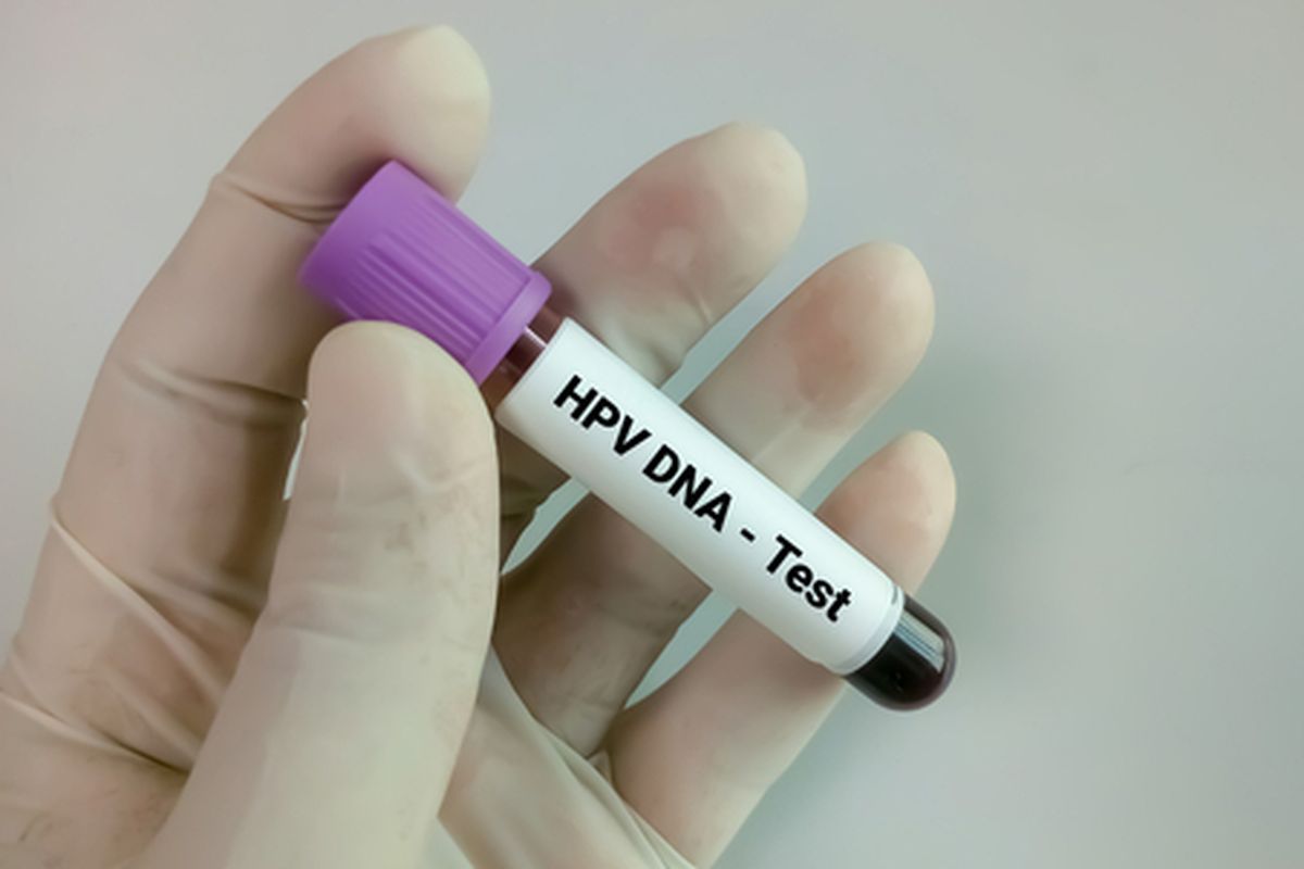 Ilustrasi tes HPV DNA. Ahli di India menduga kasus kanker di kalangan anak muda terkait infeksi HPV naik, yang mudah menular melalui hubungan seks dan kontak kulit ke kulit.