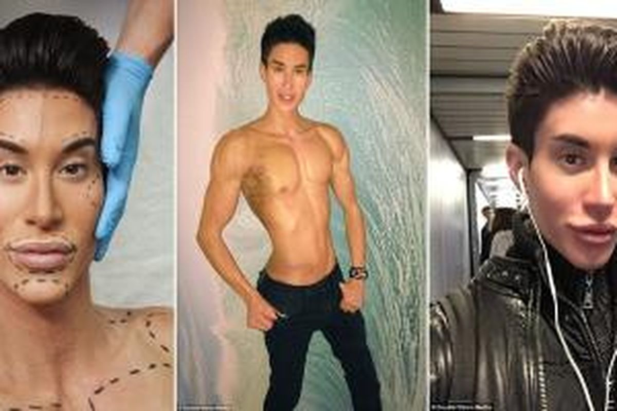 Justin Jedlica (34) sudah menjalani 190 operasi bedah kosmetik, tapi dia mengatakan bahwa jalannya menuju kesempurnaan masih panjang. 