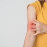 4 Faktor Penyebab Lupus yang Harus Diketahui: Ada Genetik dan Lingkungan