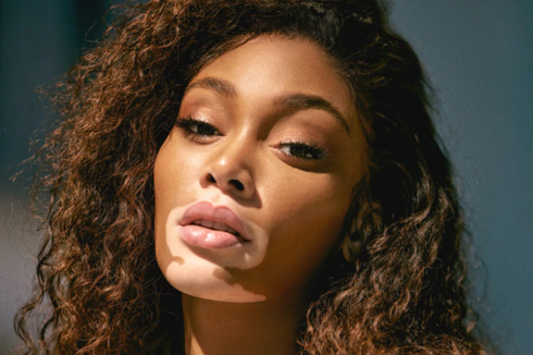 Winnie Harlow, Model dengan Kelainan Kulit Bikin Produk Tabir Surya