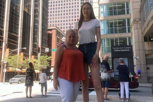 Inilah Wanita dengan Kaki Terpanjang Kedua di Dunia, Tingginya di Atas 2 Meter
