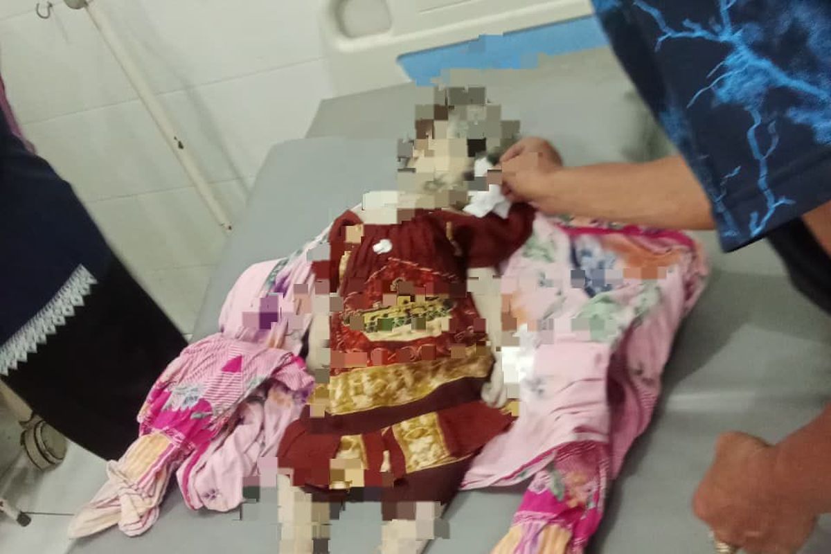 Foto: Nasib nahas menimpa bayi perempuan berinisial ZA (1,8) tahun asal Desa Gudang, Kecamatan Asembagus, Kabupaten Situbondo, Provinsi Jawa Timur yang ditemukan meninggal dunia pada Selasa (19/8/2025). 