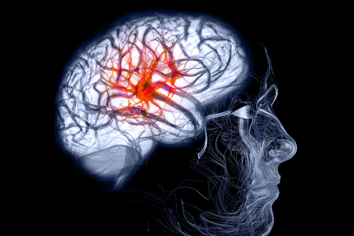 Kenali gejala aneurisma otak yang pecah dan penanganannya