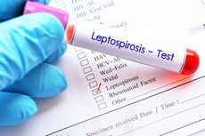  Tengah Merebak di Pacitan, Apa Penyebab dan Gejala Leptospirosis?