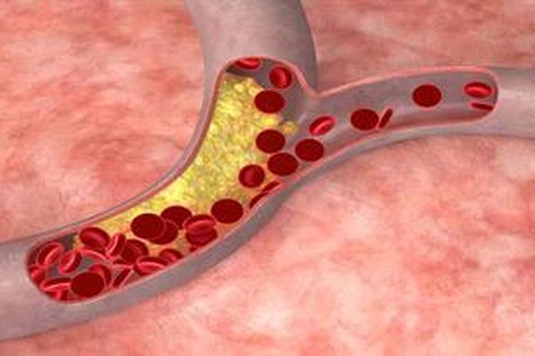 9 Makanan Pembersih Pembuluh Darah Bebas Kolesterol 