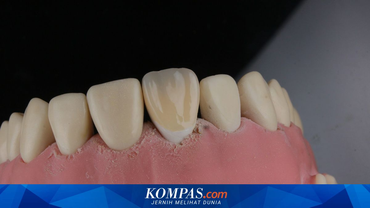 Mengeluh Sakit 1 Gigi, Pria di China Malah Kehilangan 12 Gigi dan Uangnya Dikuras Klinik