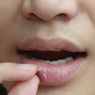 11 Penyebab Bibir Kering dan Mengelupas yang Perlu Diketahui