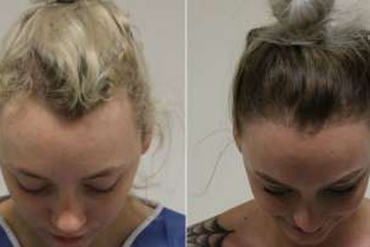 Kondisi rambut Diva Hollands, sebelum dan sesudah perawatan. 