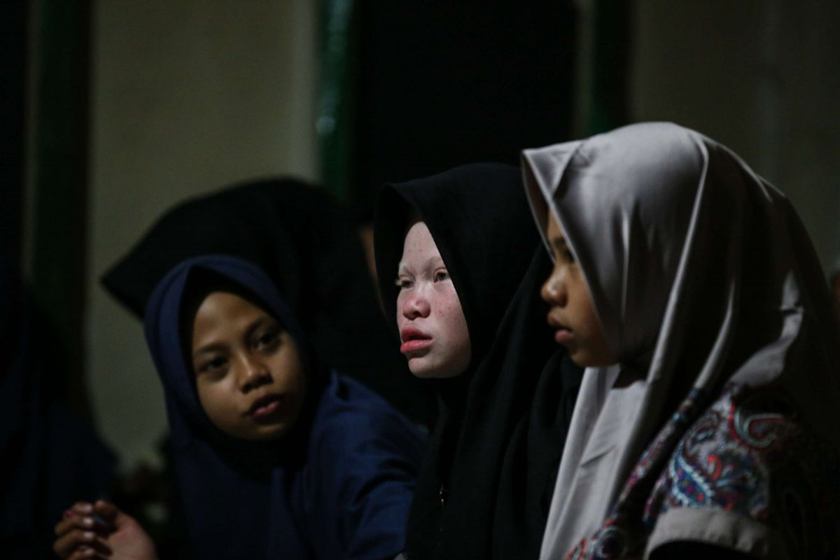 Dewi Resmana (13) salah satu anak keturunan Albino saat mengikuti pengajian bersama teman-temannya di Kampung Ciburuy, Kabupaten Garut Jawa Barat, Rabu (25/7/2018). Terdapat sembilan orang albino di Kampung Ciburuy yang menjadikannya salah satu kampung dengan tingkat albinisme tertinggi di Indonesia.