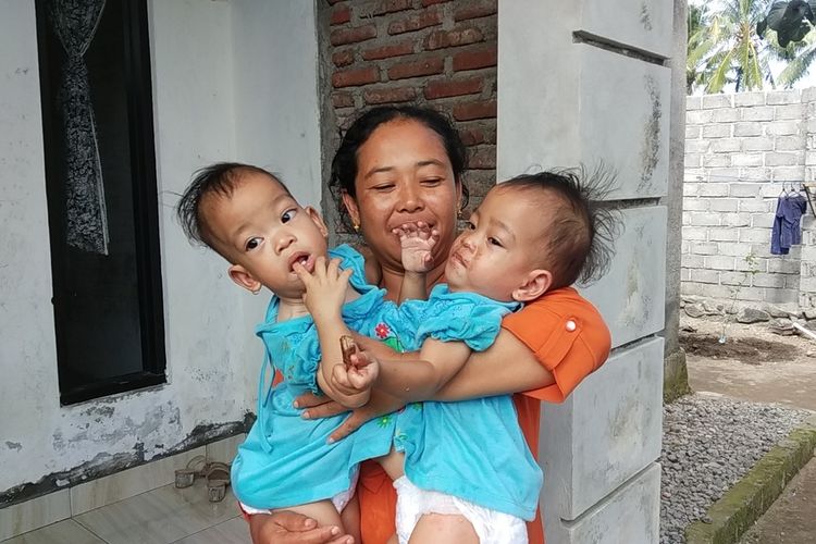 Anaya dan Inaya bayi kembar siam saat digendong ibunya Husniati