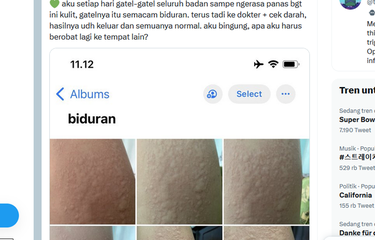 Tangkapan layar unggahan menyebut terasa gatal dan panas di seluruh kulit badan merupakan biduran