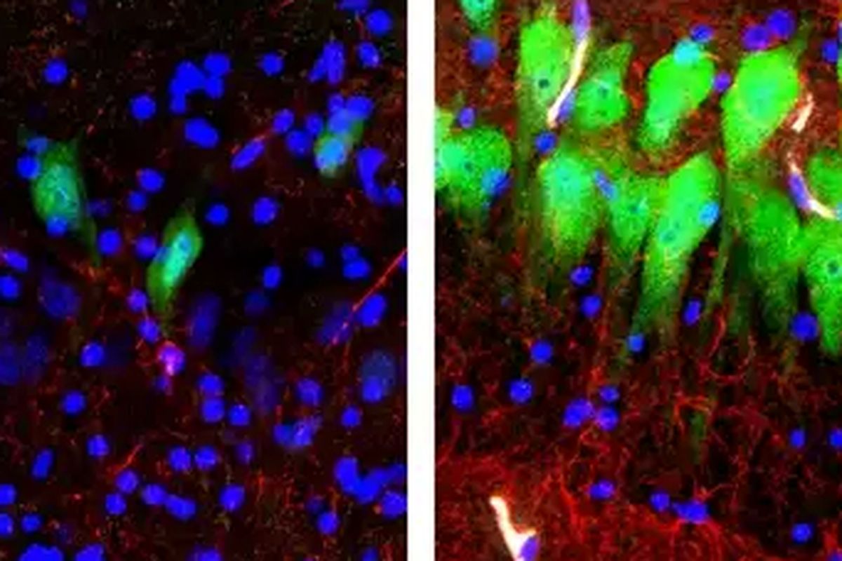 Perbandingan sel otak babi mati yang menjadi subjek studi. Gambar bagian kiri menunjukkan sel mati, yang terdiri dari neuron (hijau), astrocytes (merah), dan nukleus sel (biru) setelah 10 jam. Gambar kanan menunjukkan sel yang dirawat oleh BrainEx.