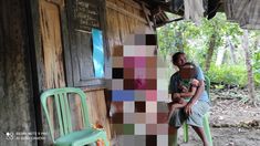 Balita Gizi Buruk Korban Penganiayaan Sadis oleh Ayah, Begini Kondisinya Sekarang