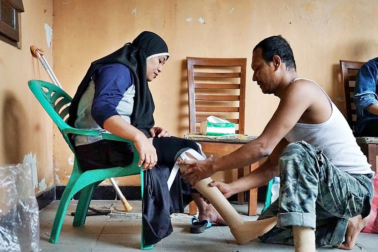 Produsen kaki palsu Ian Kapal sedang mengukur kaki palsu untuk pelanggan.