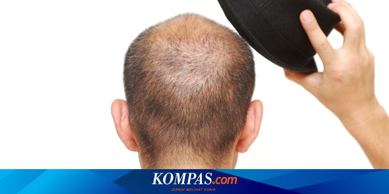 Mitos Atau Fakta Sering Pakai Topi Bikin Rambut Rontok Dan Botak
