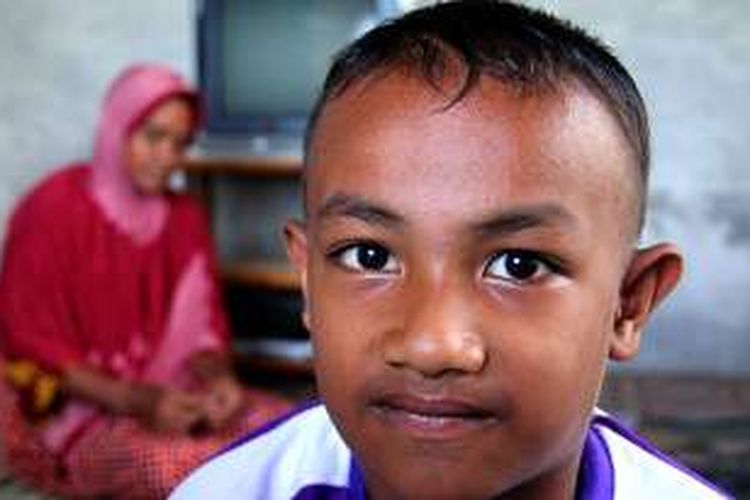 Muhajir Lutfi (5) penderita kailanan hormon tulang anak dari pasangan Azhar Daud (44) dan Nilawati (33), Desa Simpang, Kecamatan Kaway XVI, Kabupaten Aceh Barat butuh bantuan biaya pengobatan.