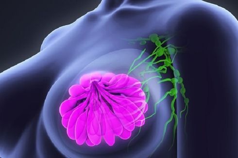 3 Temuan Terbaru Pengobatan Kanker Payudara yang Bangkitkan Harapan