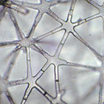 Jaringan parenkim bintang pada tumbuhan hidrofit