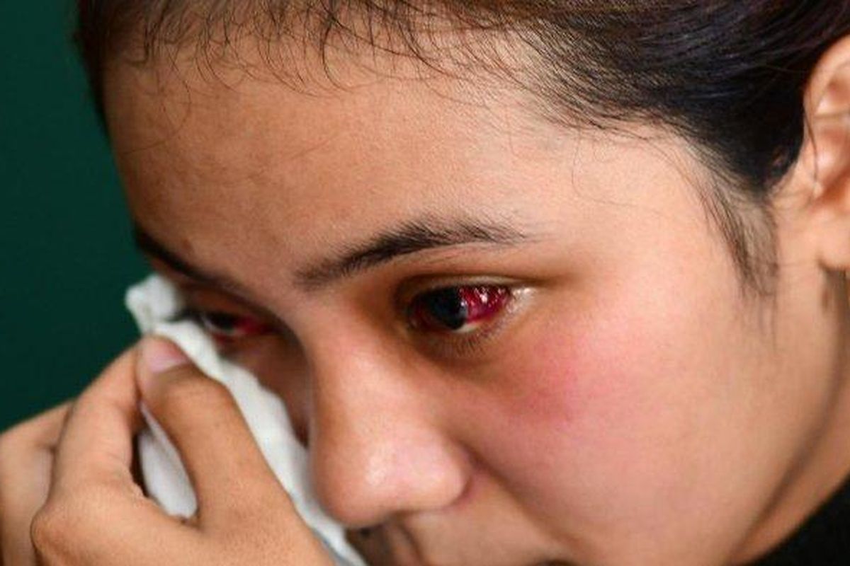 Penyintas tragedi Kanjuruhan, Kevia Naswa Ainur Rohma, menceritakan detik-detik insiden Sabtu kelabu.