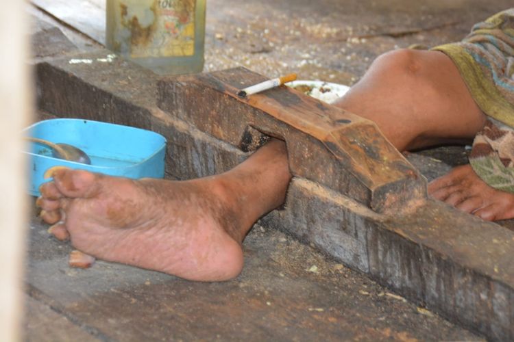 Mama Valeria Panu (62) sedang membawa sepiring nasi bagi anaknya di Pondoknya di Kampung Gulung, Desa Pong Ruan, Kec. Kota Komba, Kab. Manggarai Timur, Flores, NTT, Jumat, (1/11/2019). (KOMPAS.com/MARKUS MAKUR)

Gambar 02
Maximilianus Bombang (41) yang di pasung di pondoknya di Kampung Gulung, Desa Pong Ruan, Kec. Kota Komba, Kab. Manggarai Timur, Flores, NTT, Jumat, (1/11/2019). (KOMPAS.com/MARKUS MAKUR)