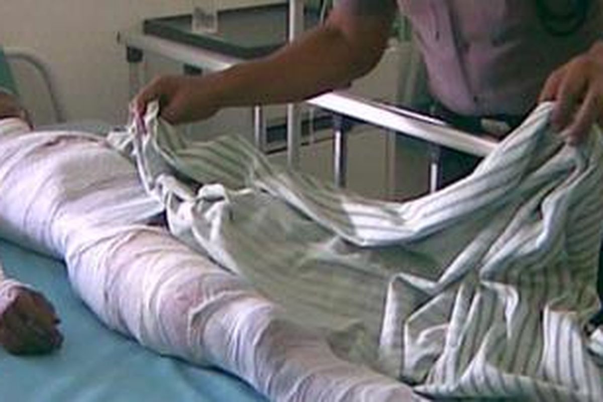 Nekad mencuri kotak amal di Mesjid Nurul Falah yang terletak di Dukuh Sidorawuh, Desa Sidogemah, Kecamatan Sayung, Demak, Sholikin (34) nyaris kehilangan nyawanya karena dibakar massa. 