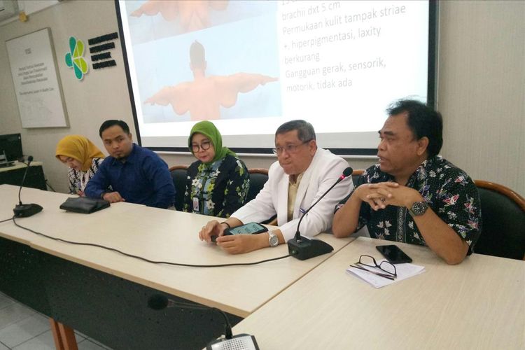 Tim dokter tengah melakukan konferensi pers terkait persiapan operasi kulit gelambir Arya Permana bocah obesitas dari Karawang.