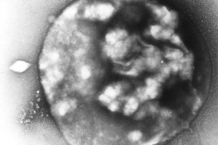 Contoh Organisme Archaebacteria