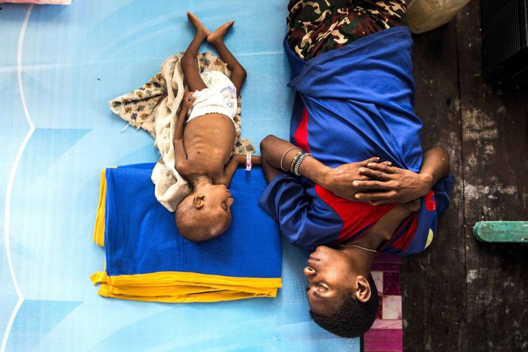 Seorang ibu bersama anaknya Amatus (3) tertidur di Aula Gereja Protestan, Agats, Kabupaten Asmat, Papua, Senin (22/1/2018). Jumlah anak penderita gizi buruk dan campak yang dirawat sebanyak 85 orang diantaranya di RSUD Agats 40 anak dan 45 anak di aula gereja Protestan Indonesia.