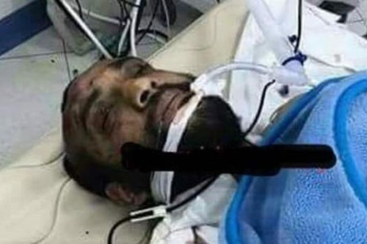 Foto pria yang diduga pelaku penyerangan ke gereja Kristen Koptik di Kairo tengah menjalani operasi.