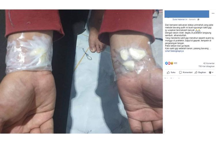 Viral Benarkah Tempelkan Bawang Putih Di Tangan Bisa Sembuhkan Sakit Gigi Halaman All Kompas Com